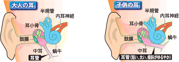 大人の耳 子供の耳:耳管(短い、太い、傾斜がゆるやか)